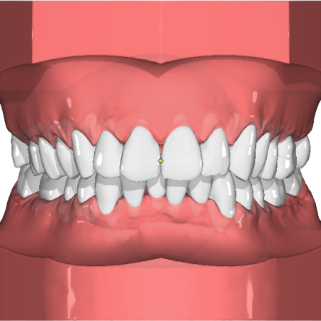 4. Segmentation